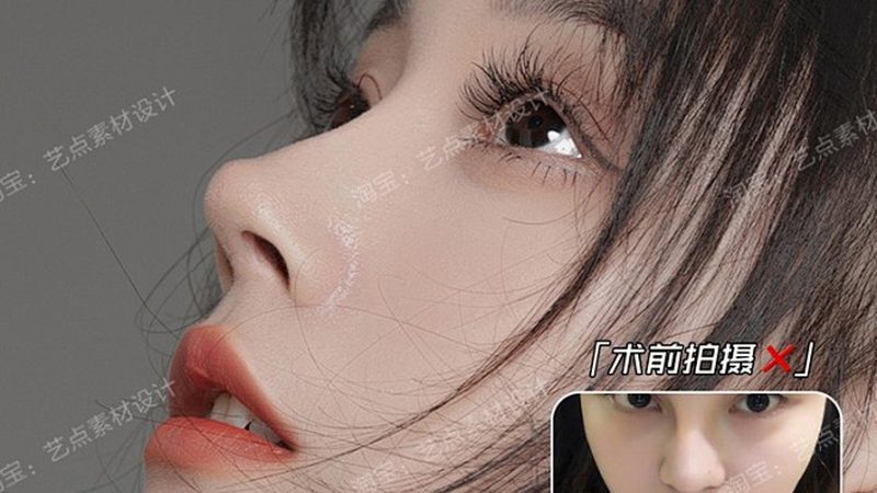 肉毒素注射瘦脸针，揭秘注射流程与步骤