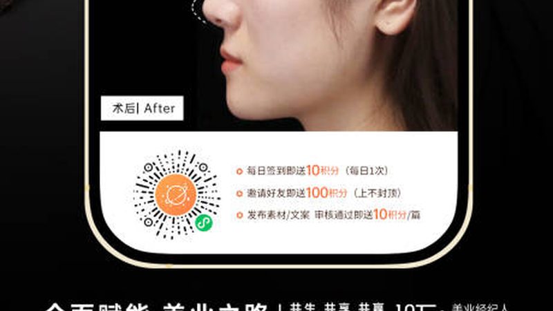 自体软骨隆鼻后多久戴眼镜