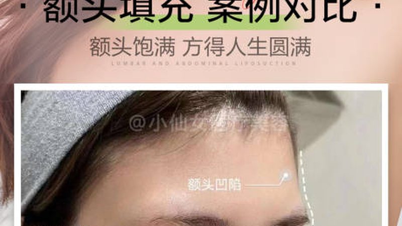 轻医美项目大盘点：揭秘热门项目背后的秘密