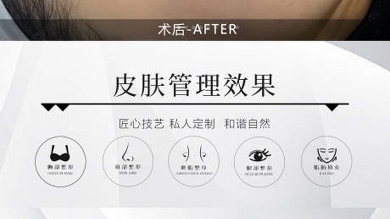 杭州整形医院隆胸手术：揭秘完整手术流程