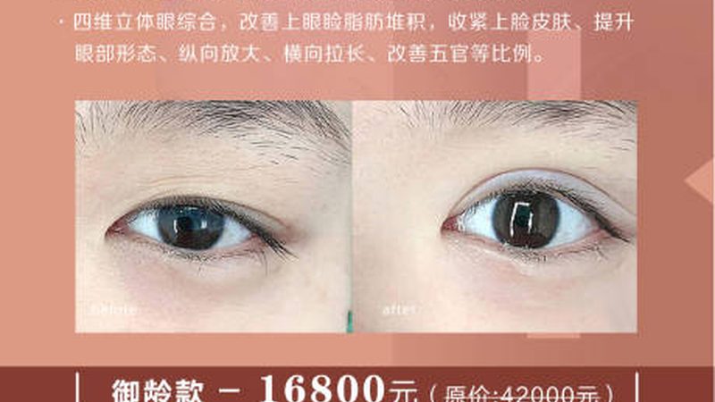 热玛吉：面部与眼部美容的秘密武器，优缺点全解析