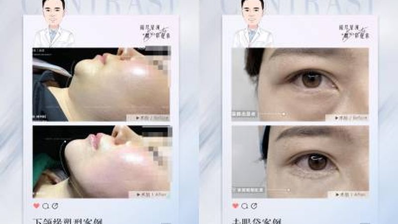 家用超声炮：使用前的五大注意事项**