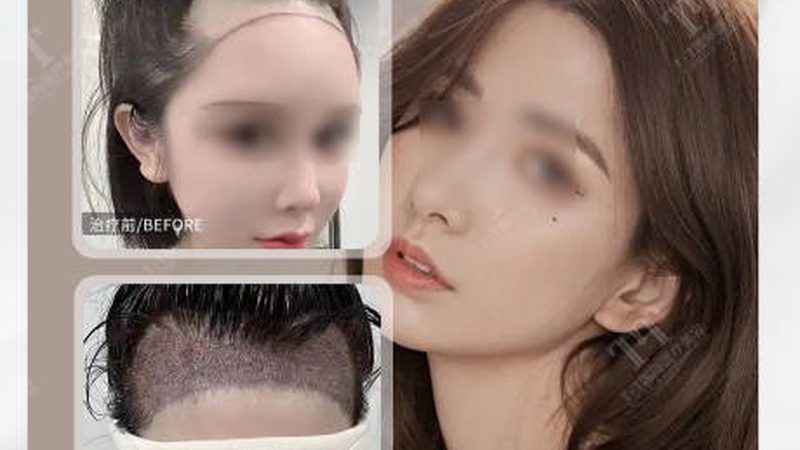 轻医美项目，美丽无负担，揭秘十大品牌背后的秘密