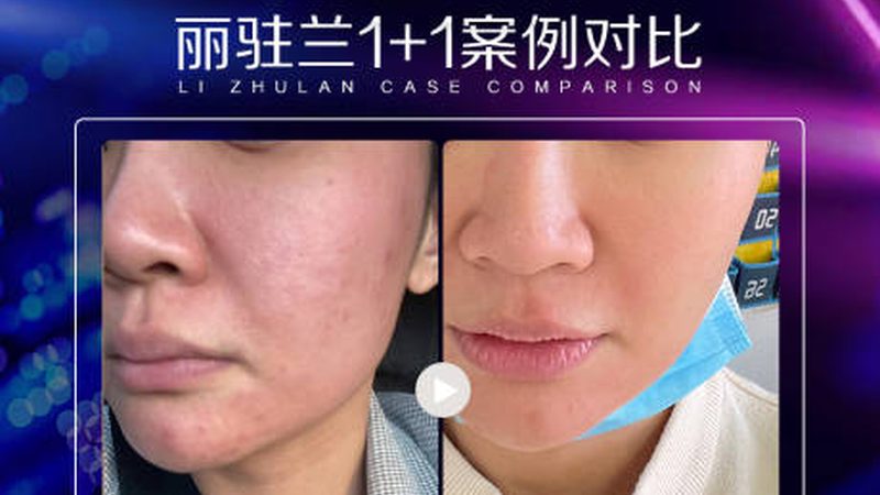 整形美容术前流程，揭秘费用构成与关键环节