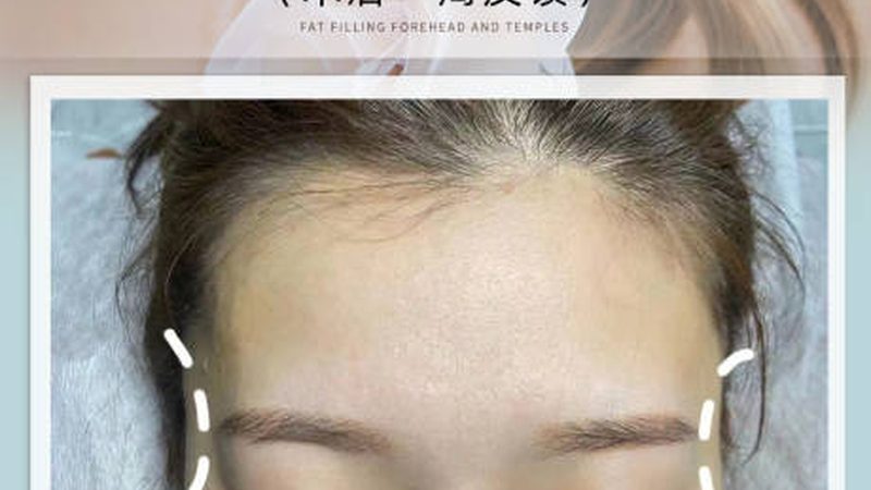 线上还是线下？揭秘医美咨询师培训的优劣势