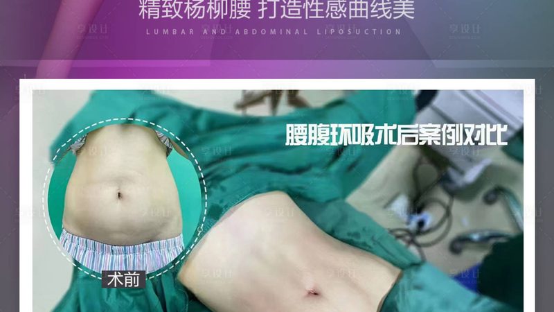 水光针OEM工厂怎么选