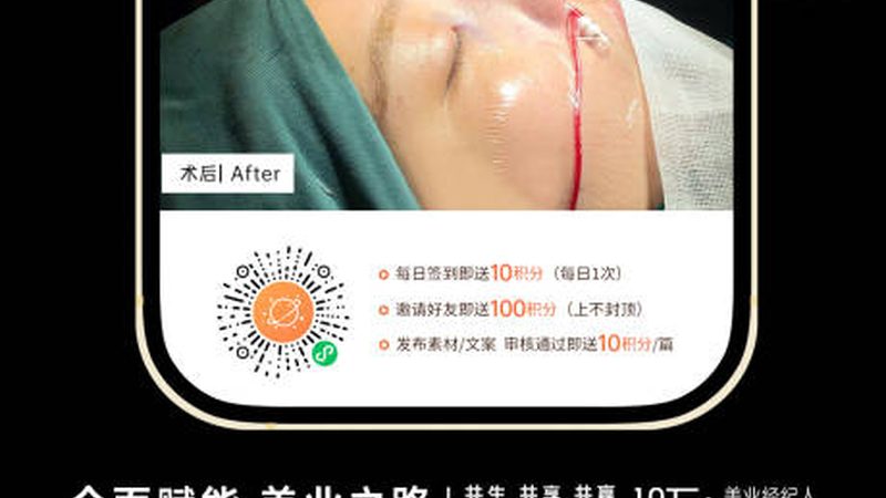 玻尿酸填充：揭秘北京脸颊填充的费用构成**