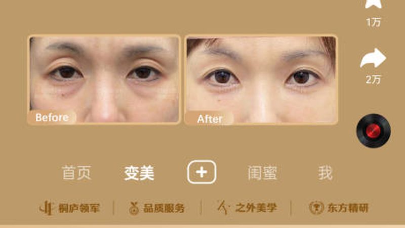 超声炮：揭秘性价比背后的技术奥秘**