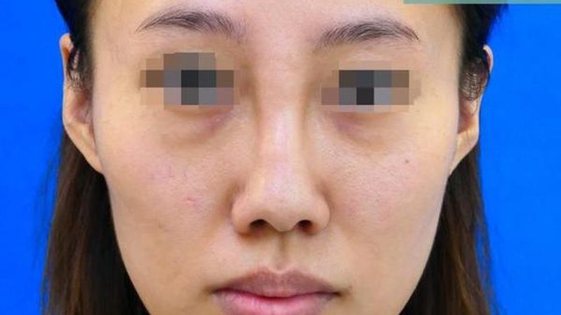 脸部瑜伽，轻松打造精致小脸